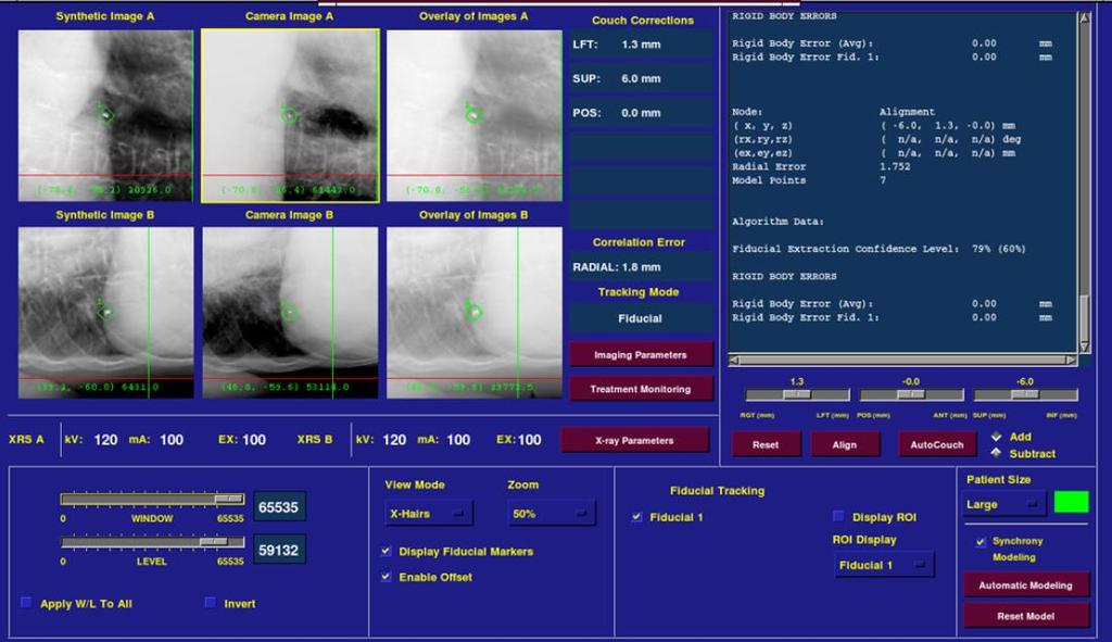 Fiducial Tracking and Correction