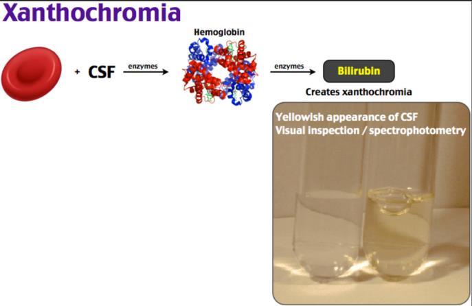 What is Xanthochromia? Xanthochromia is a finding seen in CSF after SAH.