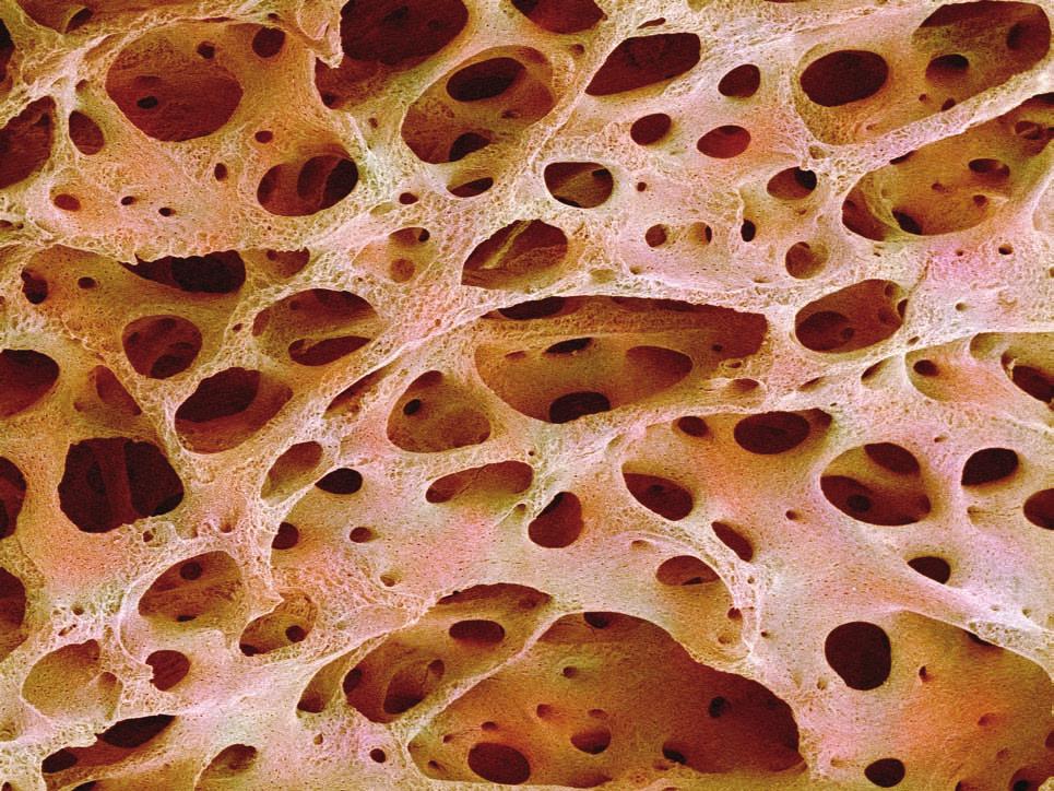 we were still young! There are two main types of cell in bone: the osteoclasts which destroy bone and the osteoblasts which make new bone. Both of these are formed in the bone marrow.
