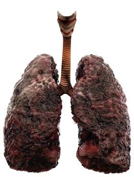 THE CONTINUOUS MONITORING OF A GENETIC MUTATIONAL PROFILE Smokers, or people at risk of developing lung cancer, can undergo a yearly checkup of their mutational