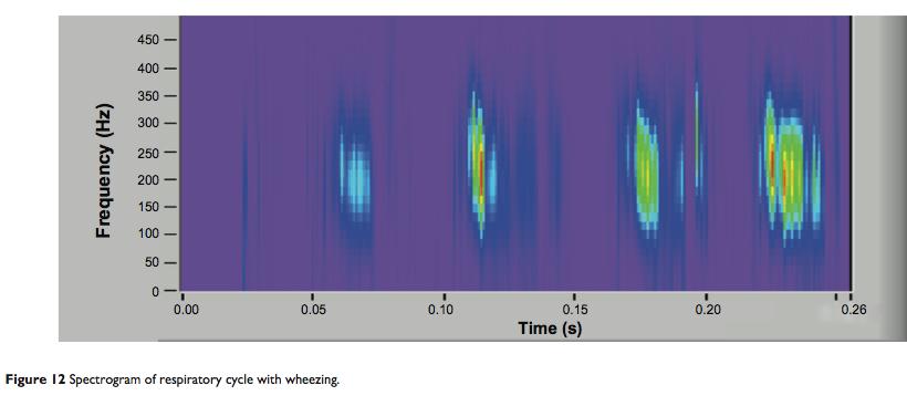 Spectrogram of Respiratory Cycle