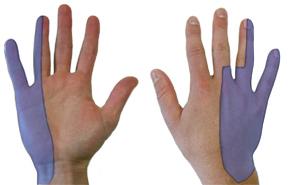 Classically, the ulnar nerve gives sensation to the small finger and part of the ring finger.