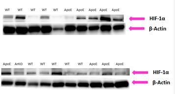 Figure 21: Representative example of western blot of in vivo HIF-1α expression in primary and secondary EO771 tumours from wild type, ApoE and ApoE/ArKO mice Tumour lysates for each mouse were