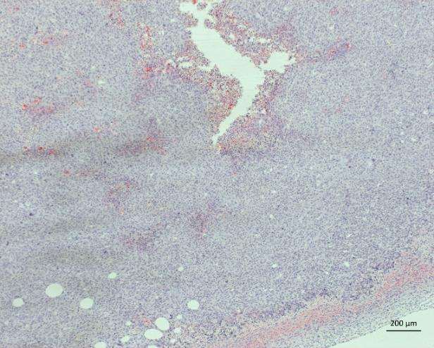 A B C Figure 24: Representative hypoxia staining of pimonidazole in