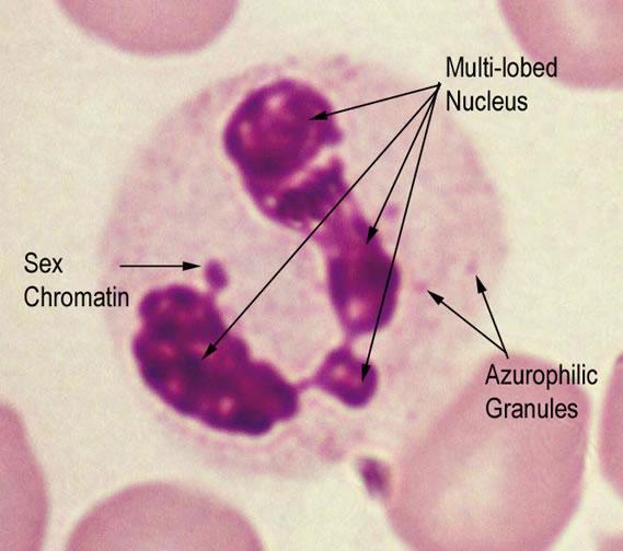 Role of Inflammatory Cells (Nat Med 2010) Neutrophil Azurophilic primary granules contain myeloperoxidase (MPO).