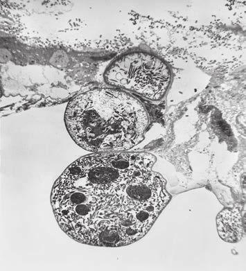 7 Fig. 3.1 is a transmission electron micrograph showing the developing Plasmodium cells inside a protective structure known as an oocyst.