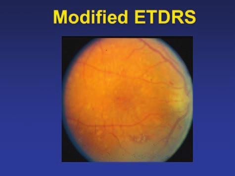 NEW INSIGHTS INTO THE MANAGEMENT OF DIABETIC MACULAR EDEMA AND RELATED CONDITIONS What about central subfield thickness on OCT?