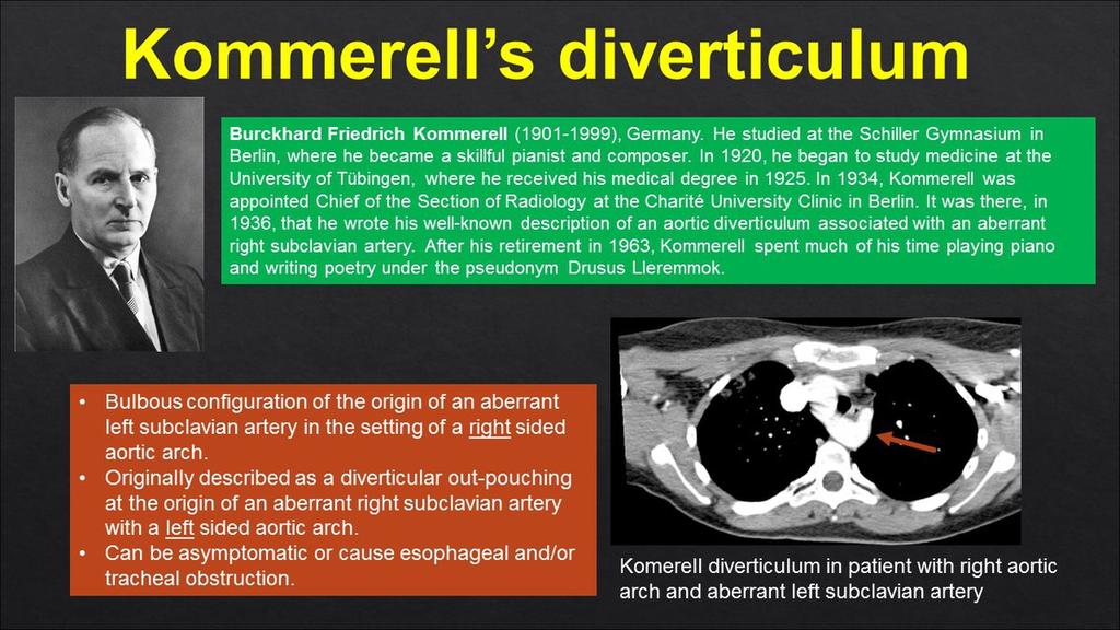 15: Komerell diverticulum in patient with right