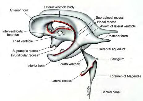 Cerebral Ventricles Hydrocephalus and Effects of Interruption of CSF Flow Tube