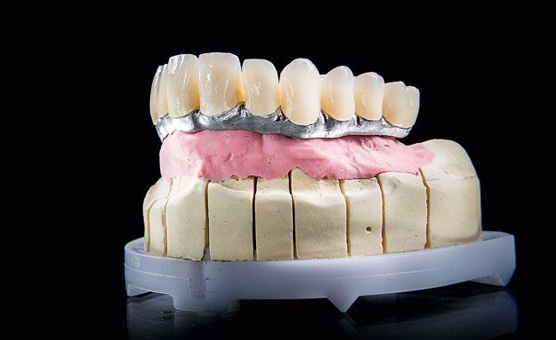 13-15 The finished ceramic crowns were bonded to the conditioned Ceramill Sintron frame using Multilink
