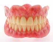Acrylic Partial Dentures Acrylic partial dentures are usually the most cost effective and can be made within a short period of time.