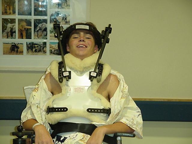 Halo Vest A device that is used for unstable cervical