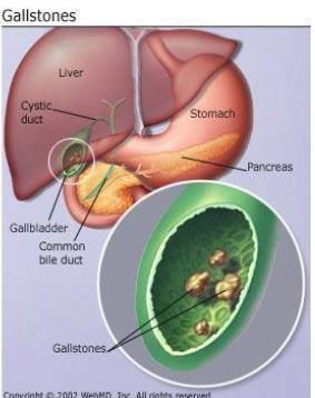 Arterial supply of the gallbladder The cystic artery, a branch of the right hepatic artery, supplies the gallbladder Venous drainage Opposite to the arterial supply, the cystic vein directly drains