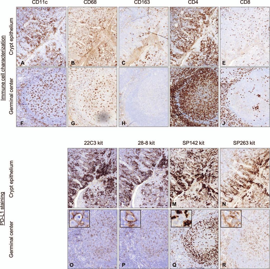 Figure 1. Overview of immunohistochemistry staining of serial sections in tonsil.