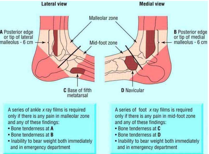 LOWER LIMB Toes 1. DP 2. DP Oblique Big Toe (hallux) 1. DP Foot 1. DP 2. DP Oblique in cases of a suspected or seen - Lisfranc injury 3. Lateral in cases of suspected but not seen Lisfranc injury 4.