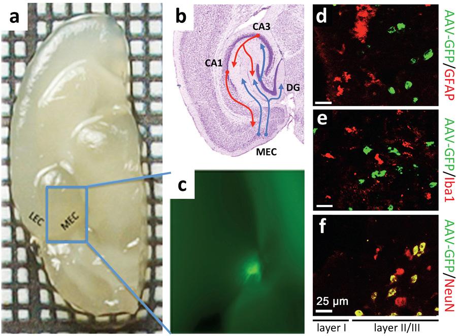Supplementary Figure 1 AAV-GFP injection in the MEC of the mouse brain C57Bl/6 mice at 4 months of age were injected with AAV-GFP into the MEC and sacrificed at 7 days post injection (dpi).