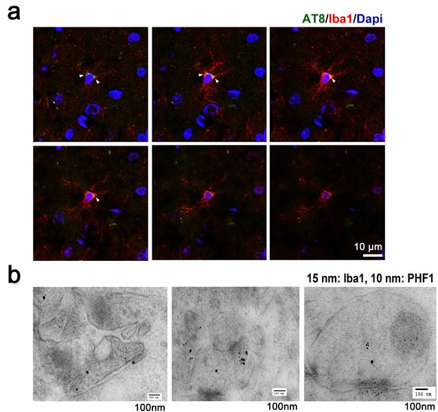Supplementary Figure 4 Colocalization of ptau within Iba1-positive microglia (a) Sequential imaging of confocal microscopy in the hippocampal area of the 6 month-old PS19 mouse brain.