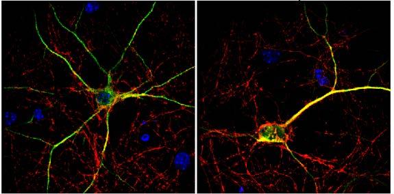 hippocampal neurons CM Aβ Aβ + C31