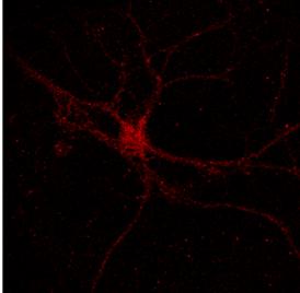 LM11A-31 p-nr2b intensity / neuron (%