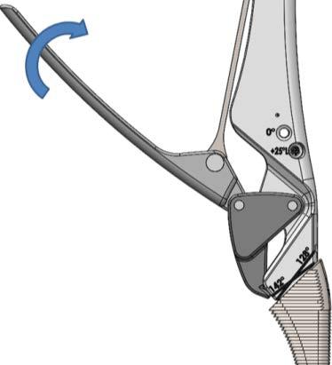 slot of the broach and close the lever to insert the medial tip and lock the