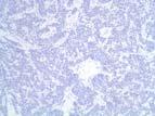 conventional cytogenetics (requires live cells)