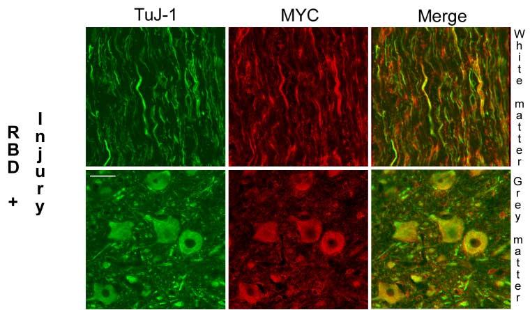 Supplemetary Figure 2 Colocalization of myc staining with anti-neuron-specific b tubulin III (TuJ-1) in the spinal cord.