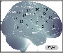 Neuropharmachological assessment: Results MPH ADHD N=16 ATX ADHD N=16 10 10 Monden et al., NeuroImage:Clin (2012) Effect size 0.95 Nagashima et al., Neurophotonics (2014a) Effect size 0.