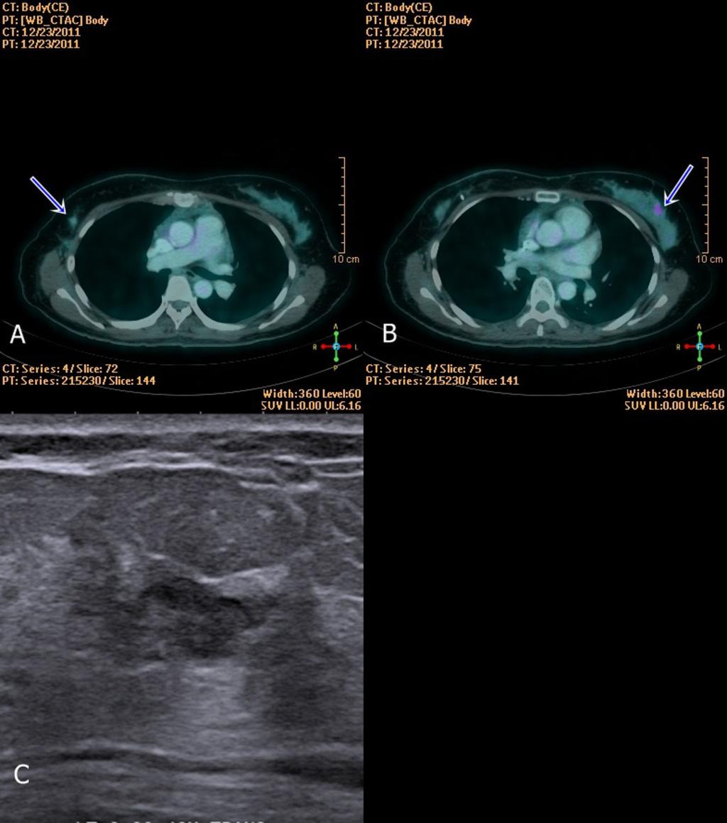 Fig. 9: Another images of same patient above.