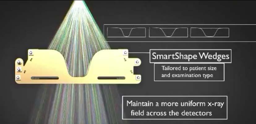 SmartShape: Increase beam hardness and reduce soft