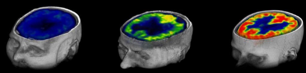 Consciousness global brain function Consciousness Neural correlates Diagnosis Prognosis
