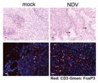 Intratumoral NDV treatment results in immune infiltration in both virus-injected and distant tumors B16-F10 melanoma model NDV mock Distant tumor NDV Cells /g tumor 6 10 6 5 10 6 4 10 6 3 10 6 2 10 6