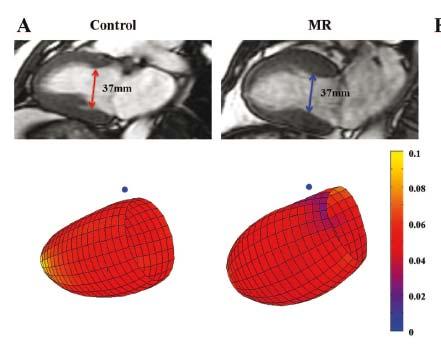 1. VOLUME, FUNCTION AND REMODELLING Systematic simulation of MR LV remodeling with respect to control.