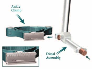 Tibial Alignment Ankle Clamp EM, Tibial Alignment Distal Assembly EM, Tibial Alignment Proximal Rod EM, Tibial Stylus, Tibial Resection Guide Modular Capture and Tibial Adjustment Housing Assembly: