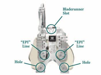 Femoral Sizing > Assemble the Femoral Sizer with the Femoral Stylus in the appropriate lateral hole, setting the stylus length to an approximate size.