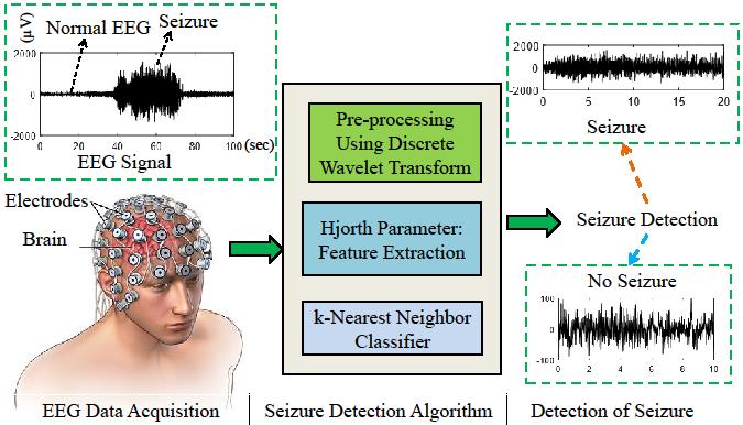 Epileptic Seizure Detection Fig. 2.