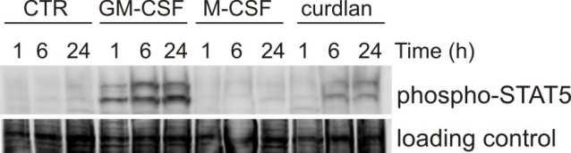 Differentiation of monocytes to macrophages GM-CSF M-CSF Monocyte M1 Macrophage M2 Macrophage