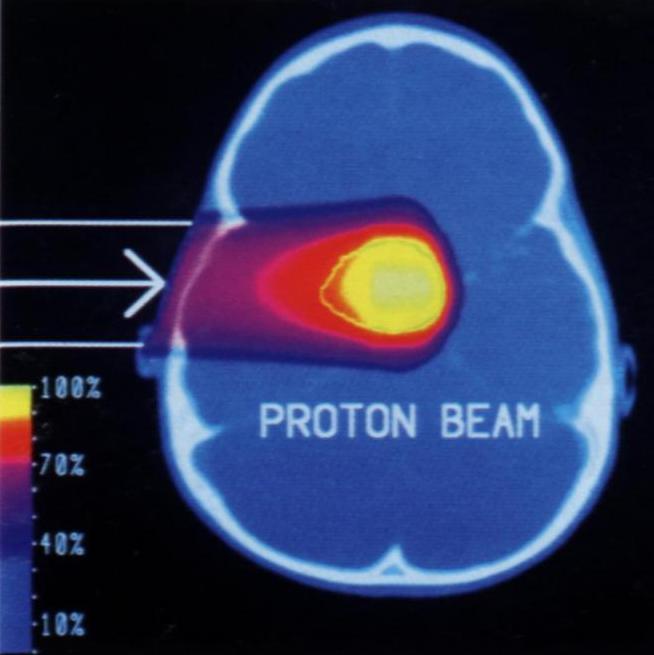 Proton beam treating