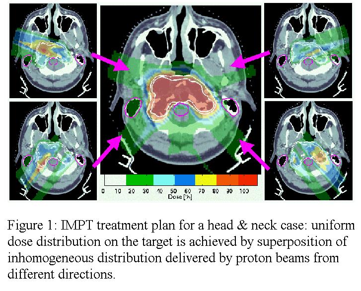 Intensity Modulated Proton Therapy