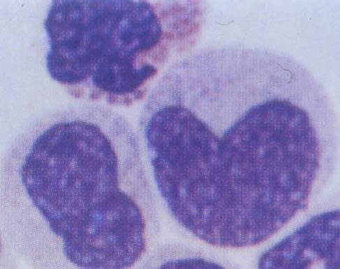 Phagocytes Monocytes, Macrophages Characteristic nucleus (kidney-shaped) Not granules, but have numerous lysosomes CD14 membrane marker Different