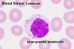 Natural killer ( NK ) cells NK APPEARENCE also known as large granular lymphocytes (LGL) are