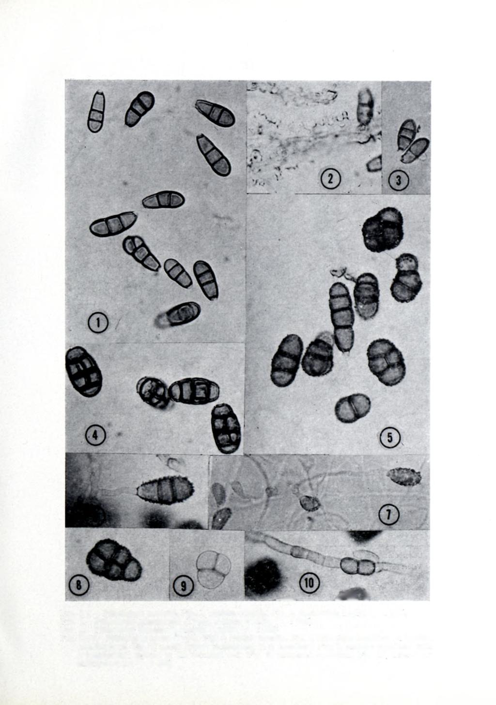 513 - ^ *.... JtB k Fig. 1-2. Pithomyces sacchari. Fig. 1, mature conidia. Fig. 2, denticulate hypha ( x 1 000).