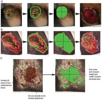Uses standardized methods for wound photography and measurement Figure 1.