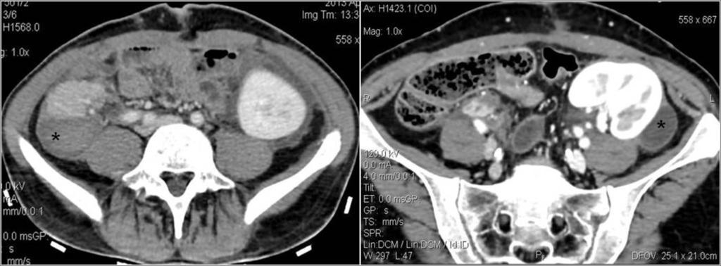 deviations. Fig. 4: CT with CE.