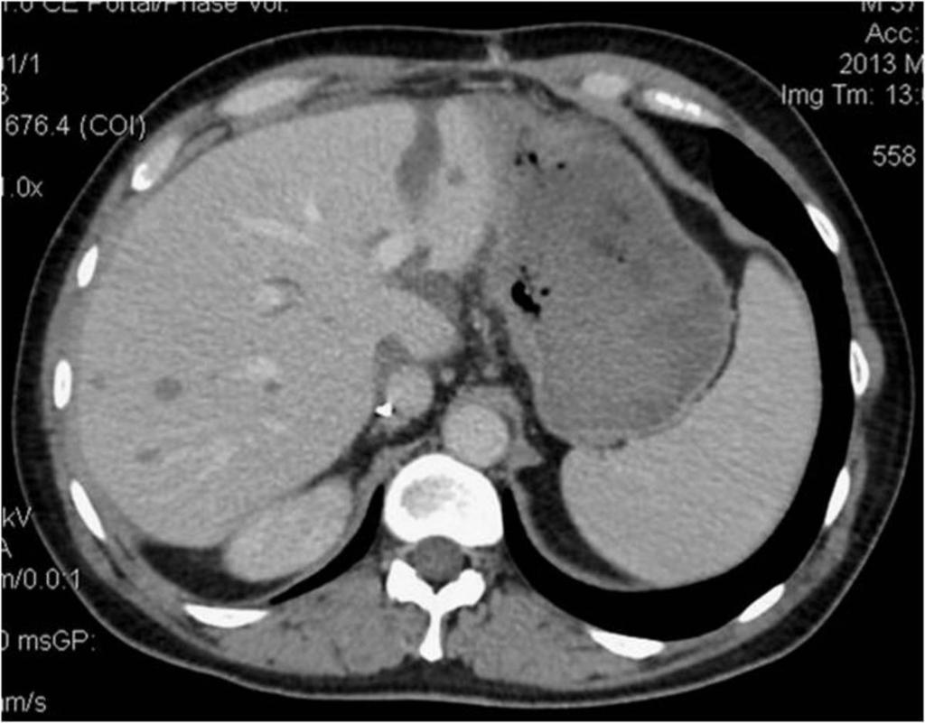 Fig. 5: CT with CE.