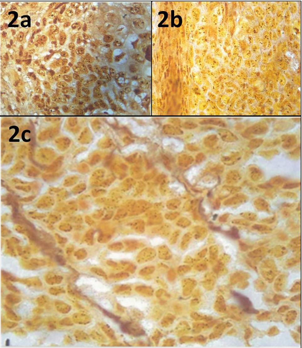 either round or elongated: the rest of the nucleus stained yellow-brown. The mean number of small NORs (Fig. 1a), large NORs (Fig.