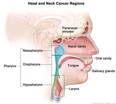What is Head and Neck Cancer Cancer arising from the lining inside the mouth and throat Oral cavity Pharynx