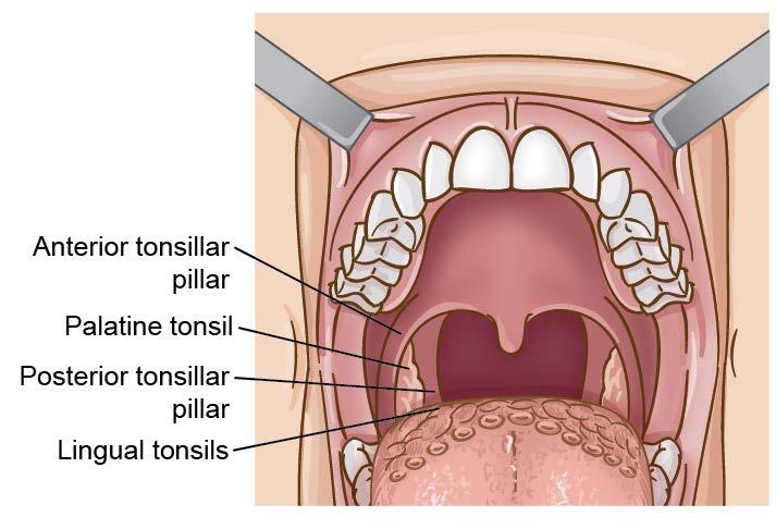 Buccal Retromolar trigone Lip Oropharynx Tonsils Base of