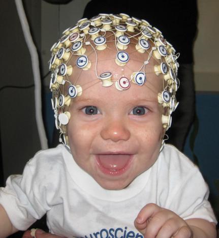 5/23/14 EEG: Not useful in predicting recurrence or epilepsy, even in complex febrile
