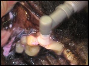 procedure. Meticulous evaluation, scaling and polishing of every surface of every tooth.