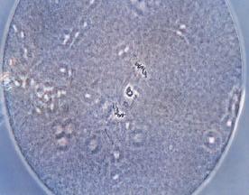 125 BCB EXPERIMENT 3: SELECTION OF IMMATURE PREPUBERTAL GOAT OOCYTES BY THE BCB TEST FOR IVM-IVF-IVC In this Experiment, the mean percentage of selected oocytes by the BCB test (BCB+) was 25.9%.
